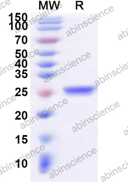 Human CRYBB1 Recombinant Protein (N-His)