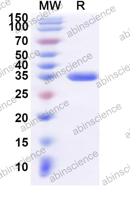 Human PTTG1IP Recombinant Protein (N-GST & C-His)