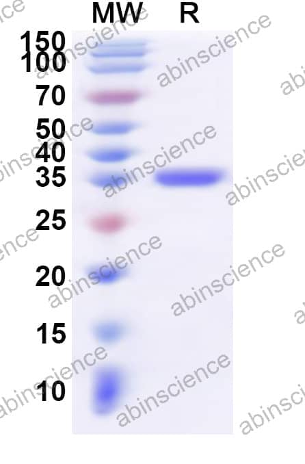 Human PTPN5 Recombinant Protein (N-His)