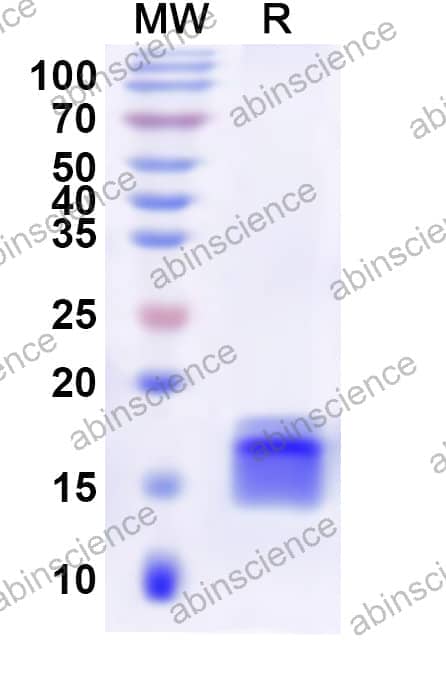 Human ELF3 Recombinant Protein (N-His)