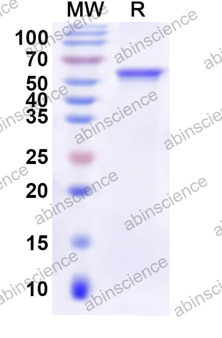 Human AFG2A Recombinant Protein (N-His)