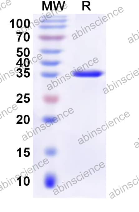 Human LSM11 Recombinant Protein (N-GST & C-His)