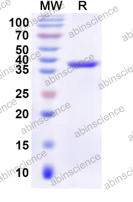 Human SLC12A8 Recombinant Protein (N-His-KSI)