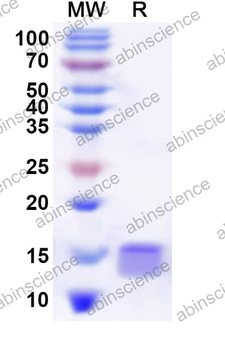 Human GTF2A2 Recombinant Protein (N-His)