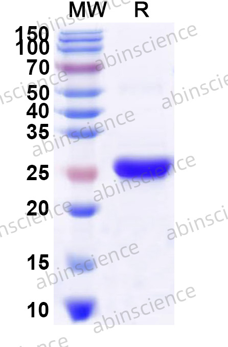 Human ATP8A1 Recombinant Protein (N-His)
