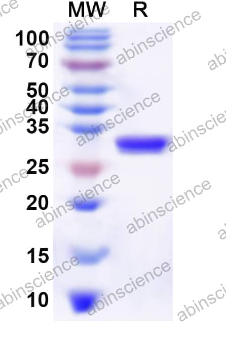 Human ID2 Recombinant Protein (N-His-KSI)