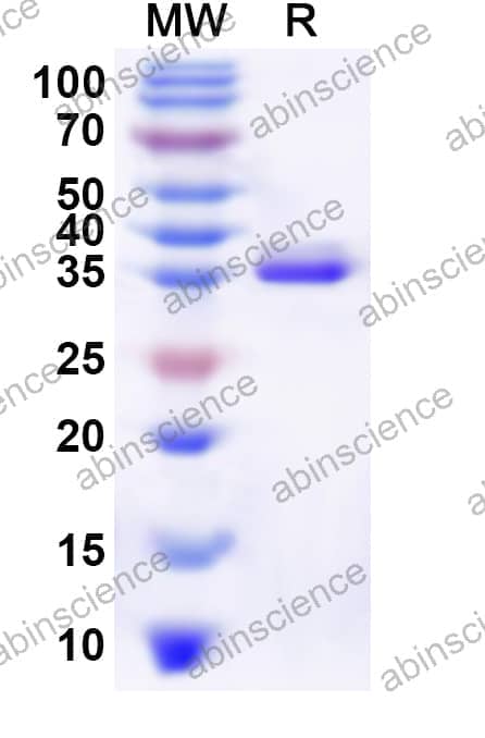 Human NHLH2 Recombinant Protein (N-His-KSI)