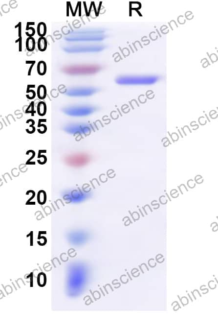Human NKX3-2 Recombinant Protein (N-His-KSI)