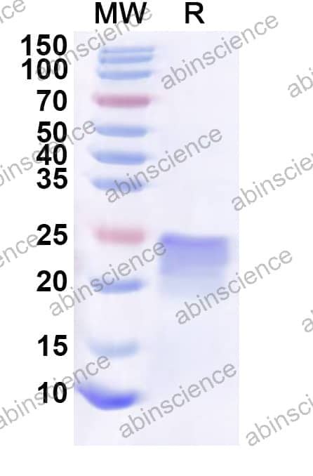 Human NBDY Recombinant Protein (N-His-KSI)