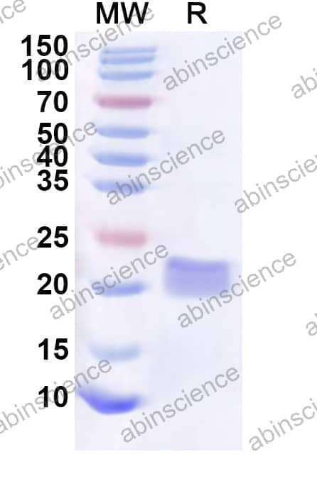 Human BCL9 Recombinant Protein (N-His-KSI)