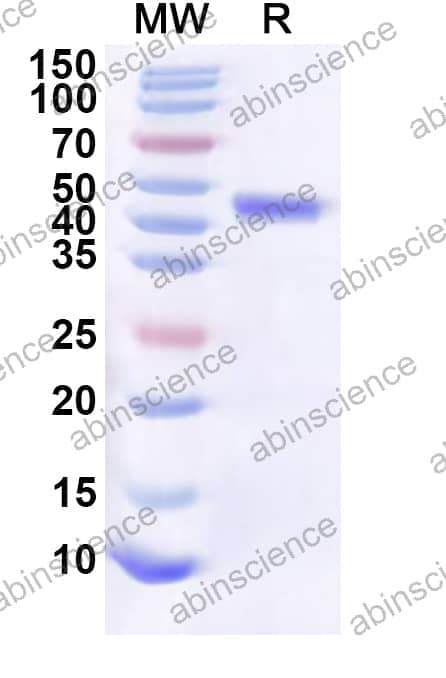 Human CASC3 Recombinant Protein (N-His-KSI)