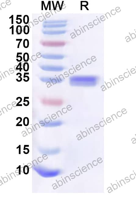 Human TLE5 Recombinant Protein (N-His-KSI)