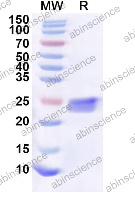 Human BBIP1 Recombinant Protein (N-His-KSI)