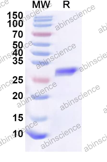 Human SRRM4 Recombinant Protein (N-His-KSI)
