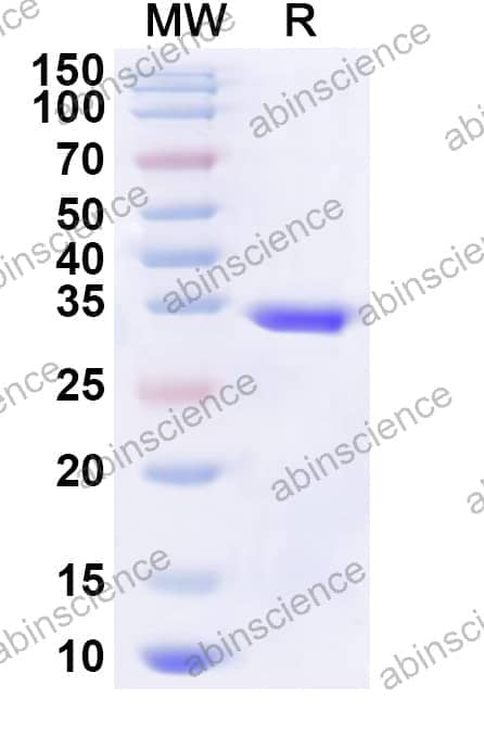 Human NUPR1 Recombinant Protein (N-His-KSI)