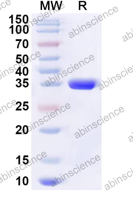 Human BEX3 Recombinant Protein (N-His-KSI)