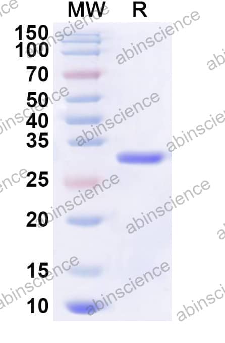 Human CREM Recombinant Protein (N-His-KSI)