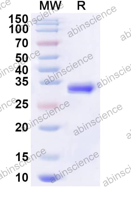 Human EIF4EBP2 Recombinant Protein (N-His-KSI)
