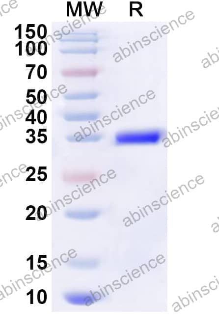 Human MOBP Recombinant Protein (N-GST & C-His)