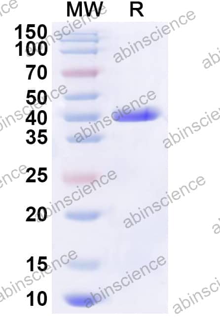 Human DGCR6 Recombinant Protein (N-His-KSI)