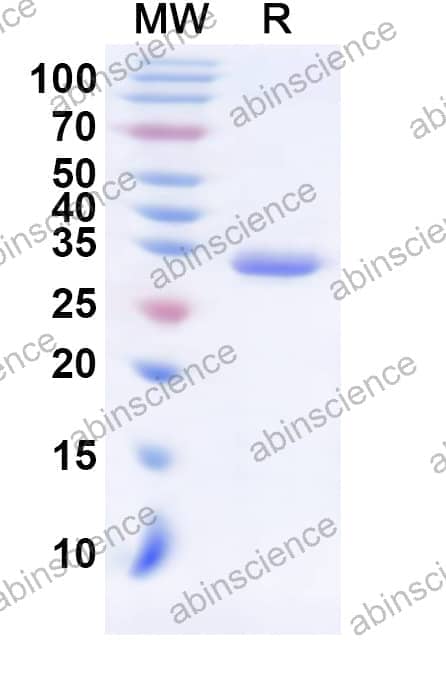Human SS18 Recombinant Protein (N-His-KSI)