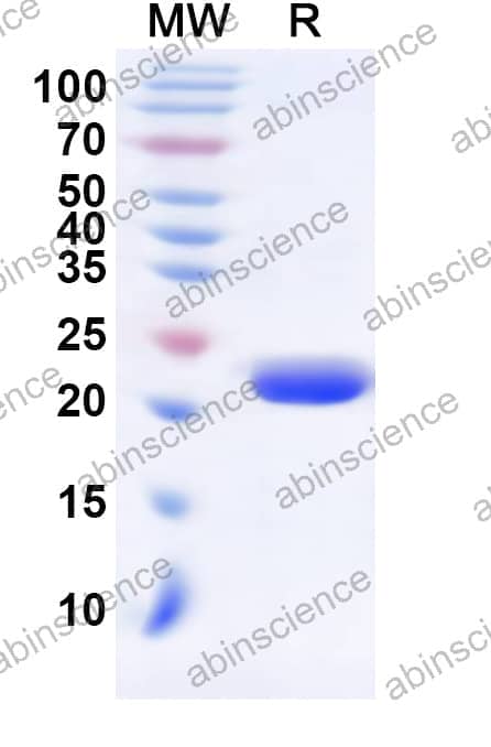 Human E2F5 Recombinant Protein (N-His)