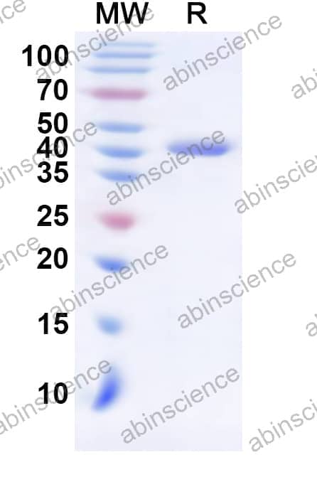 Human HLF Recombinant Protein (N-His-KSI)