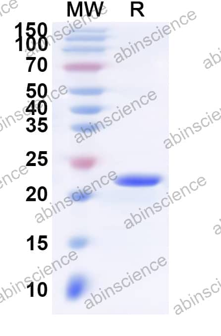 Human LTB4R Recombinant Protein (N-His-KSI)