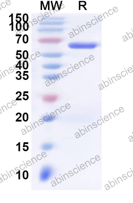 Human VPS72 Recombinant Protein (N-His-KSI)