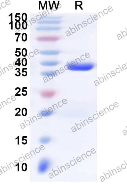 Human SSX2 Recombinant Protein (N-His-KSI)