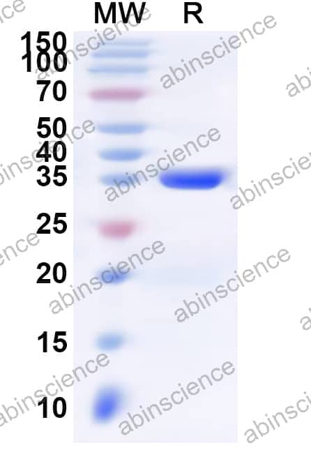 Human LCE5A Recombinant Protein (N-His-KSI)