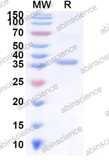 Human KRTAP13-2 Recombinant Protein (N-His-KSI)