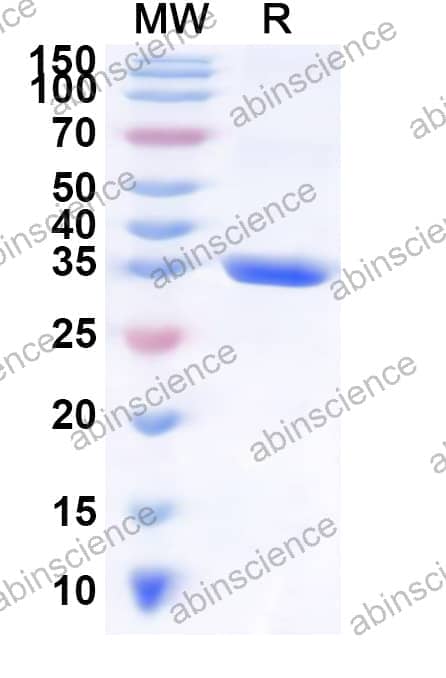 Human RNF220 Recombinant Protein (N-GST & C-His)