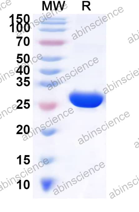 Human NKG7 Recombinant Protein (N-GST & C-His)