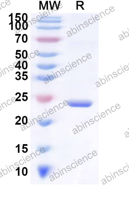 Human SLC6A19 Recombinant Protein (N-His-KSI)
