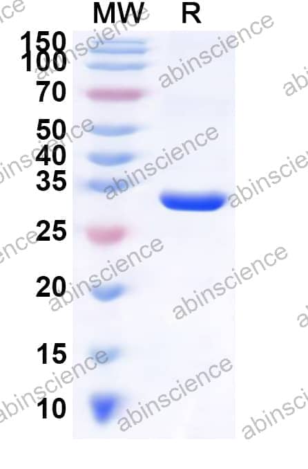 Human AMER1 Recombinant Protein (N-GST & C-His)