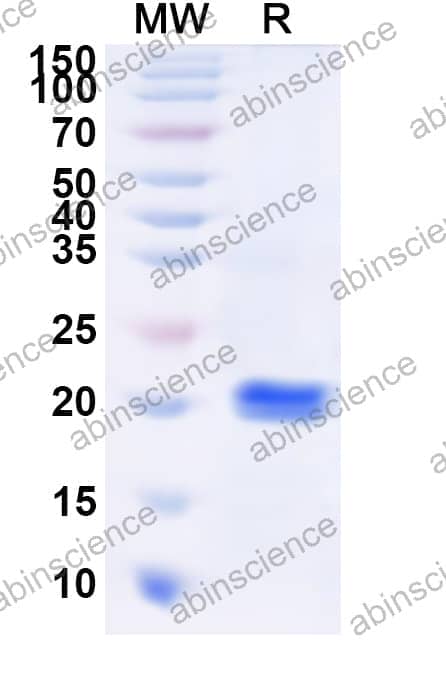 Human KRT39 Recombinant Protein (N-His)