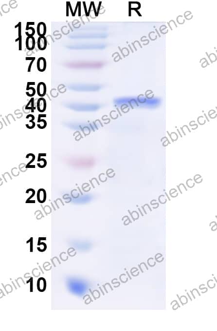 Human PSG9 Recombinant Protein (N-His)