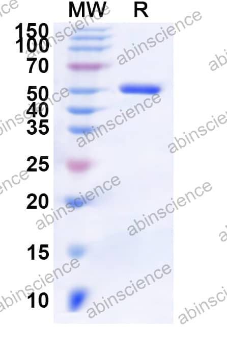 Human ALDH6A1 Recombinant Protein (N-His)