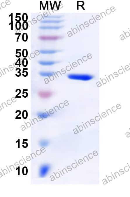 Human FOXF1 Recombinant Protein (N-GST & C-His)