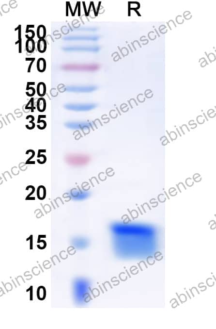 Human FOXL1 Recombinant Protein (N-His)