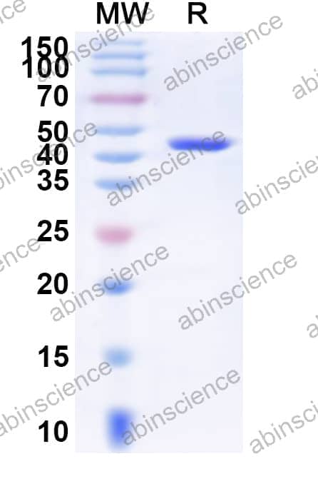 Human ERCC8 Recombinant Protein (N-His)