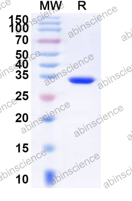 Human ZNF750 Recombinant Protein (N-His-KSI)