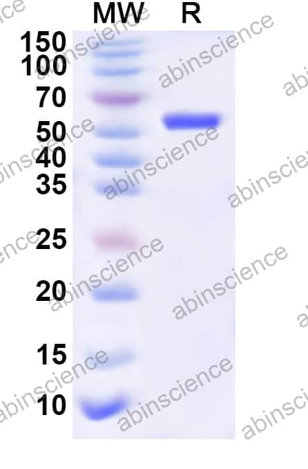 Human MTA1 Recombinant Protein (N-His)