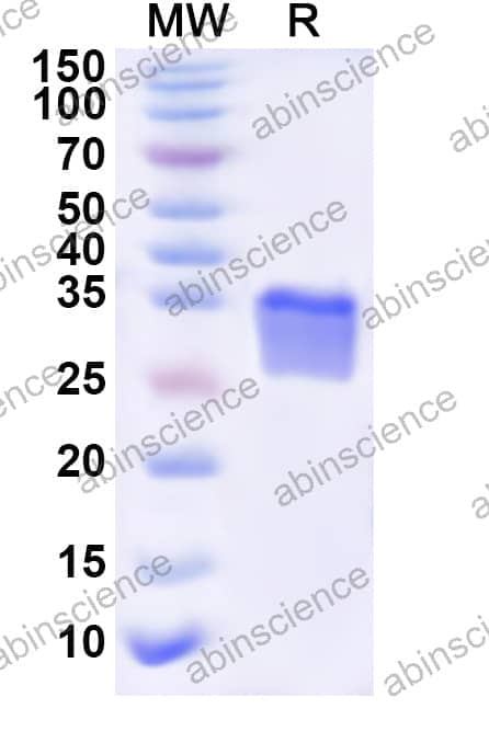 Human ART3 Recombinant Protein (N-His)