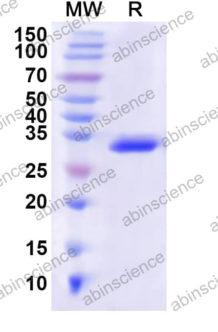 Human P2X1/P2RX1 Recombinant Protein (N-His)