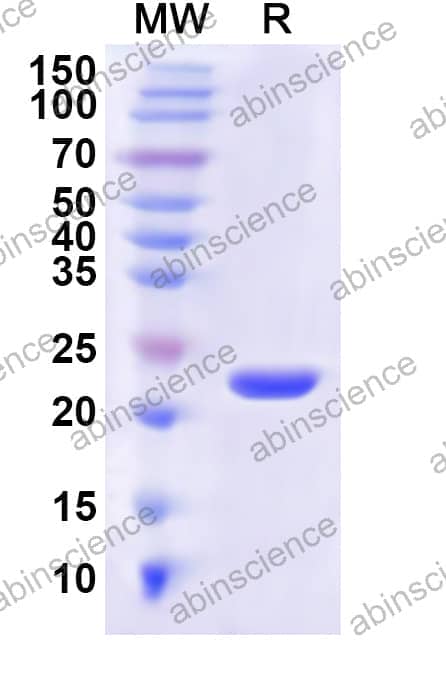 Human MLEC Recombinant Protein (N-His)