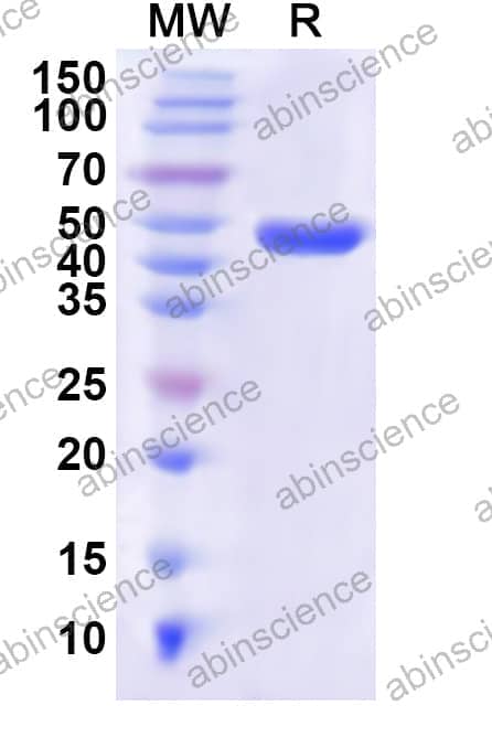 Human DPYS Recombinant Protein (N-His)