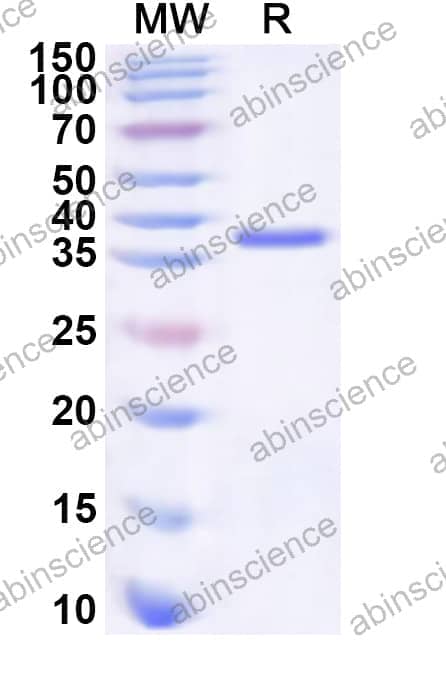 Human TGFBR3 Recombinant Protein (N-His)