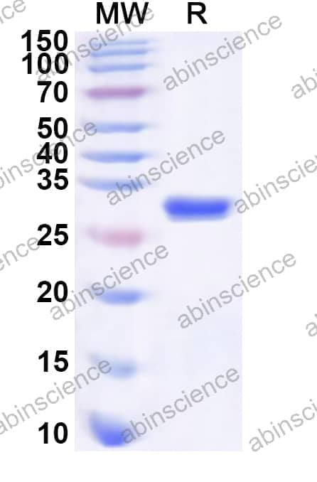Human TAP2 Recombinant Protein (N-His)